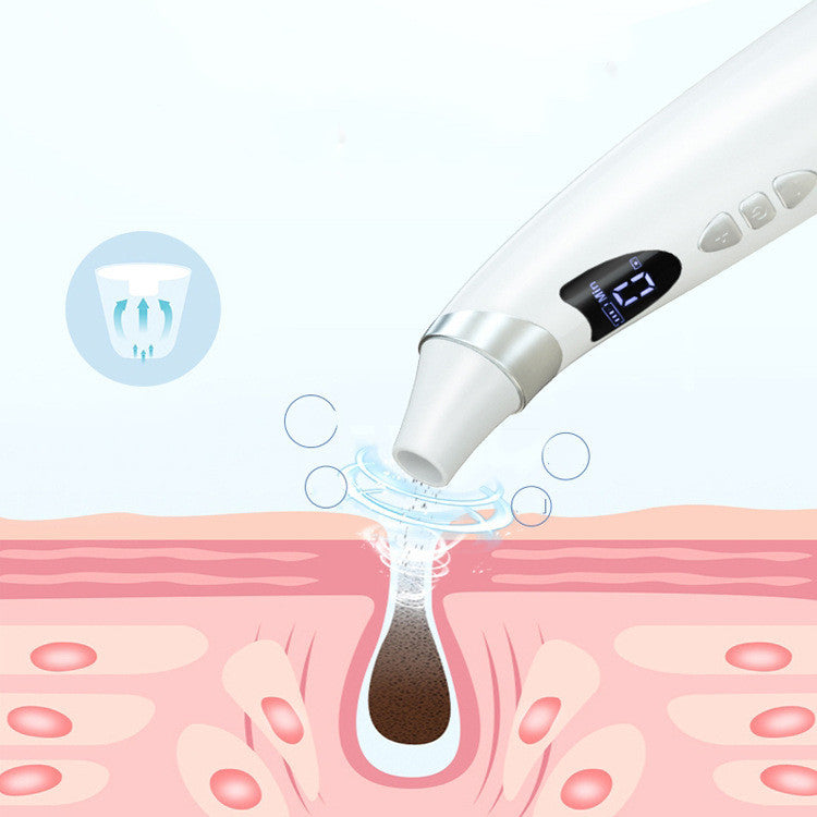 Electric Blackhead Remover & Pore Cleaner